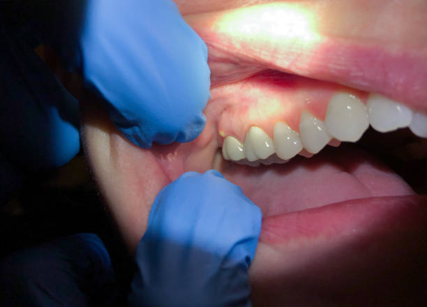 Best Emergency Broken Tooth Repair in Spring Creek, NV